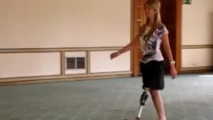 SAK Amputee Walking with Prosthesis