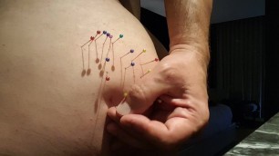 My ass as a pincushion