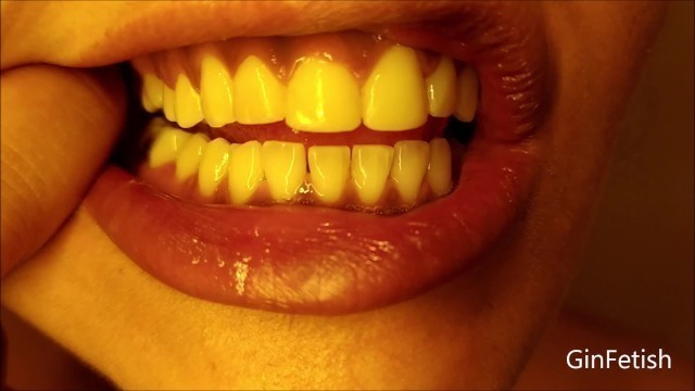 Mouth, Teeth, Tongue and Uvula Check (Short Version)